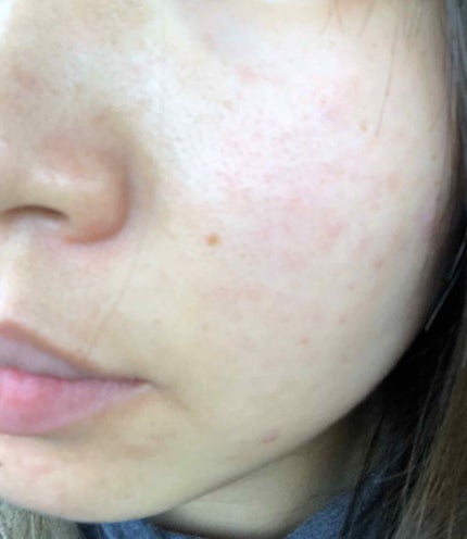 すっぴんパウダー/クラブ/プレストパウダーを使ったクチコミ(3枚目)