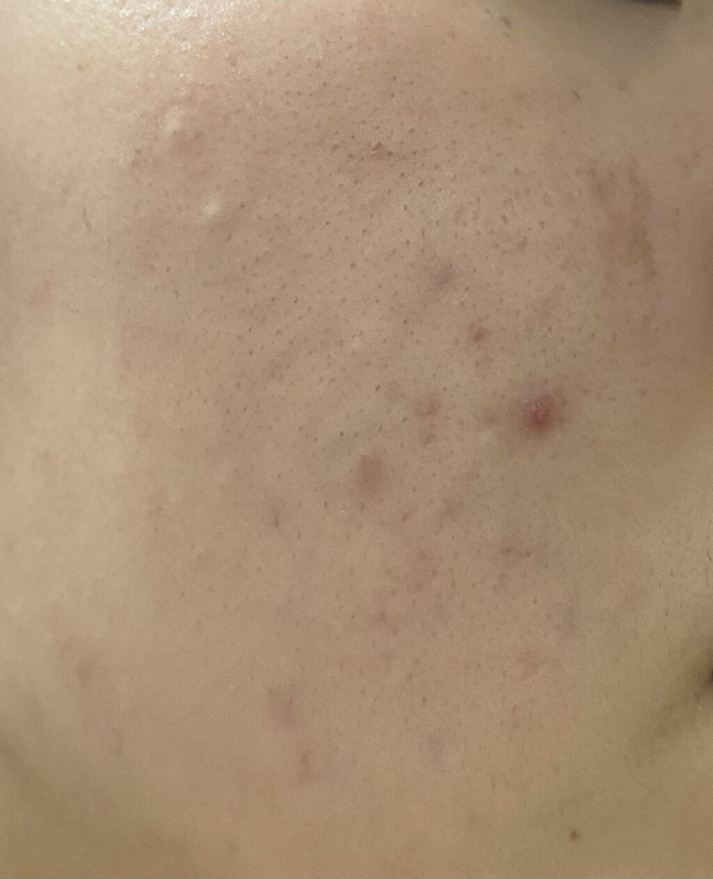 潤浸保湿 フェイスクリーム/キュレル/フェイスクリームを使ったクチコミ（2枚目）