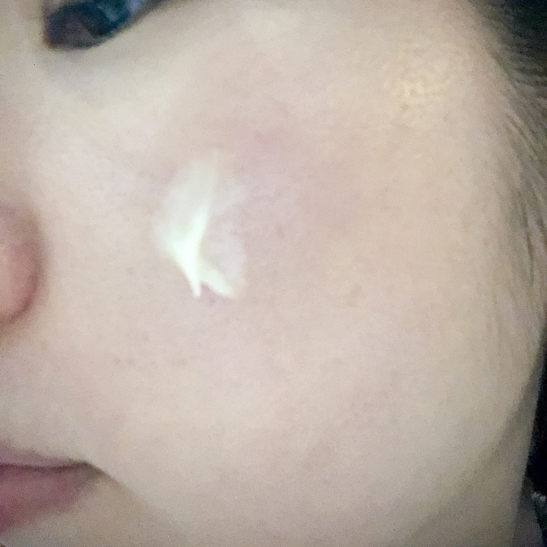 ダーマイルミネーター/ALLUDEM/美容液を使ったクチコミ（3枚目）