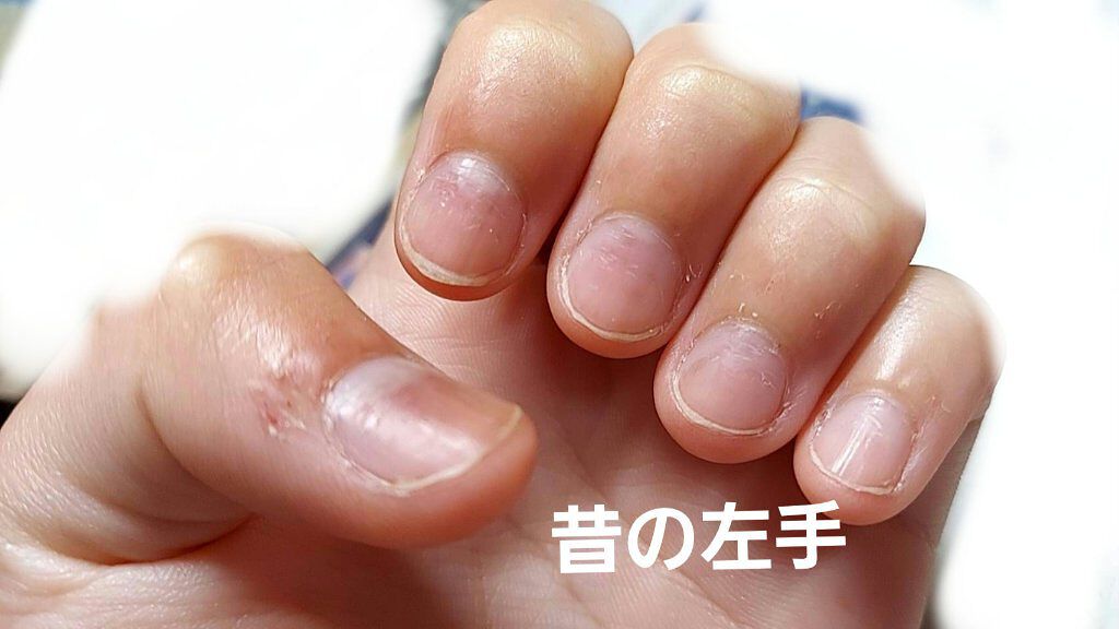 ウィンマックス ネイルケアシリーズ ベースコート/DAISO/ネイルベースコートを使ったクチコミ（3枚目）