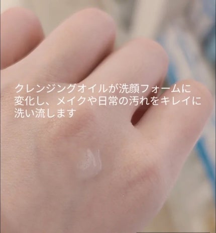 St-Care クレンジングオイルフォーム/orin/洗顔フォームを使ったクチコミ(4枚目)