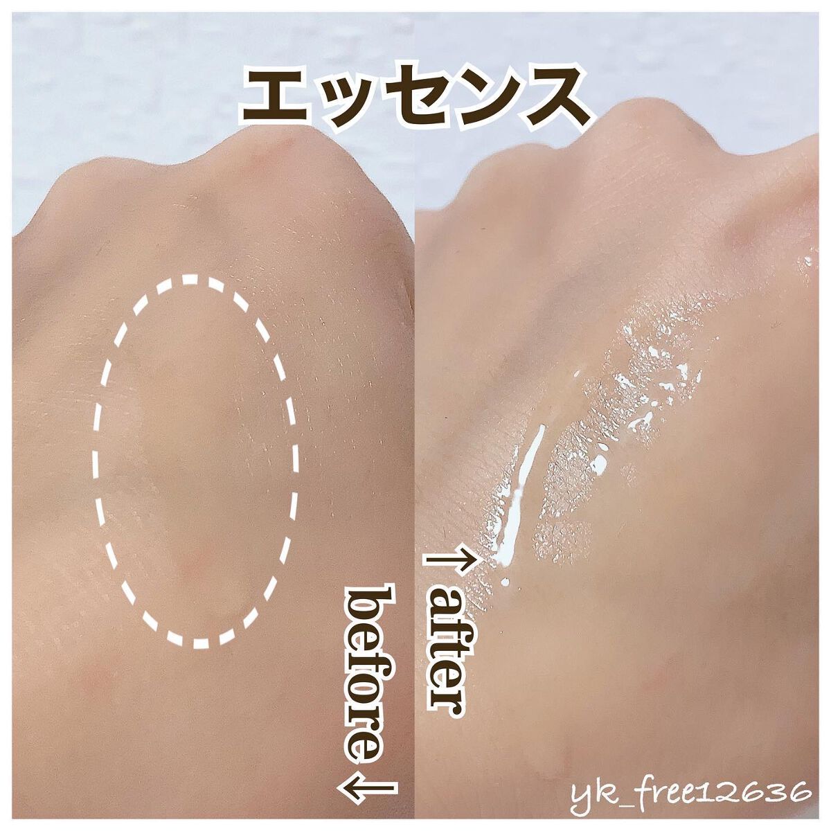 RJ トライアルセット/アピセラピーコスメティクス/スキンケアキットを使ったクチコミ(8枚目)