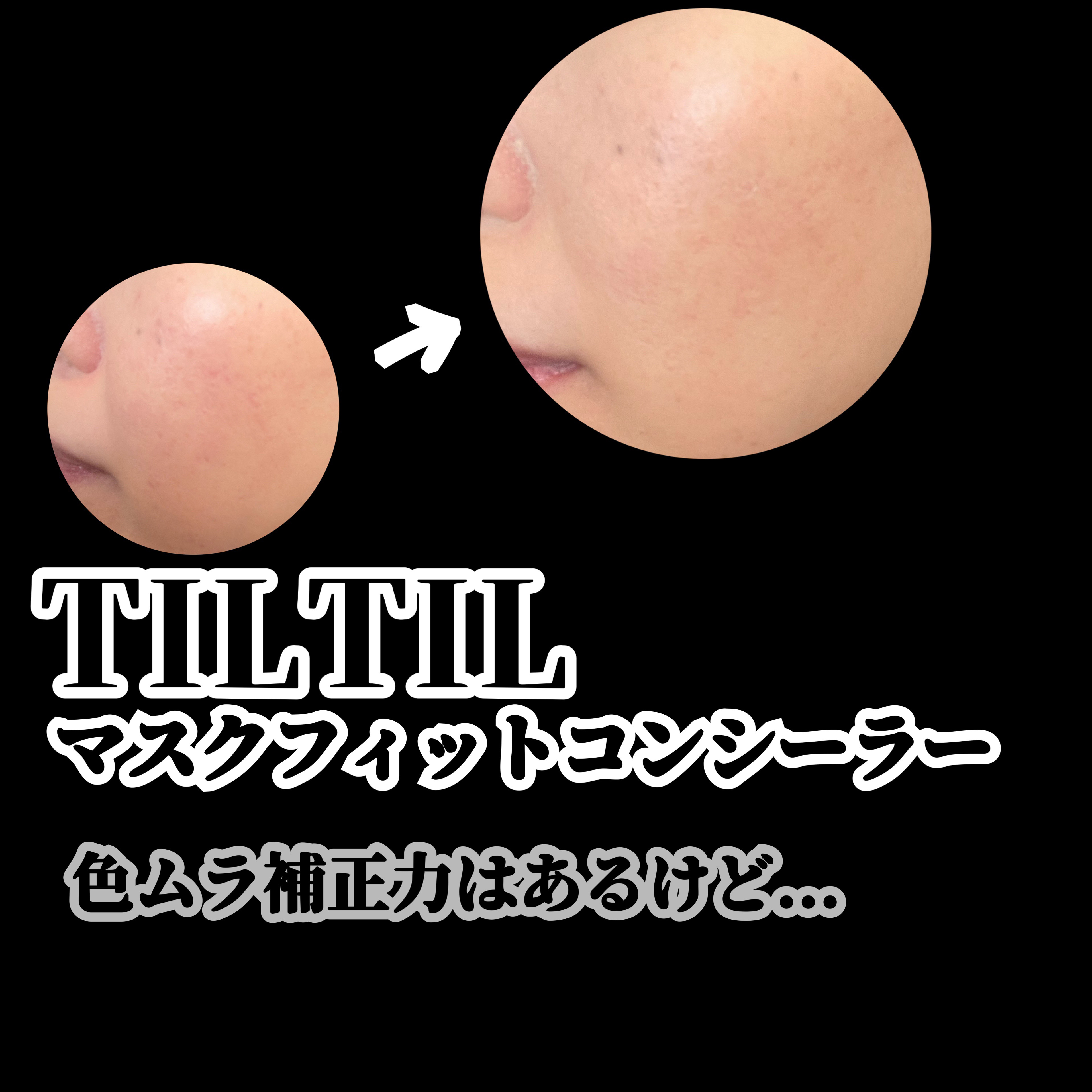 マスクフィット コンシーラーパレット/TIRTIR(ティルティル)/パレットコンシーラーを使ったクチコミ（1枚目）