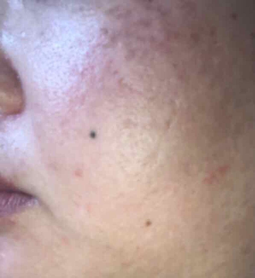 Wエッセンス/shimaboshi/美容液を使ったクチコミ(3枚目)