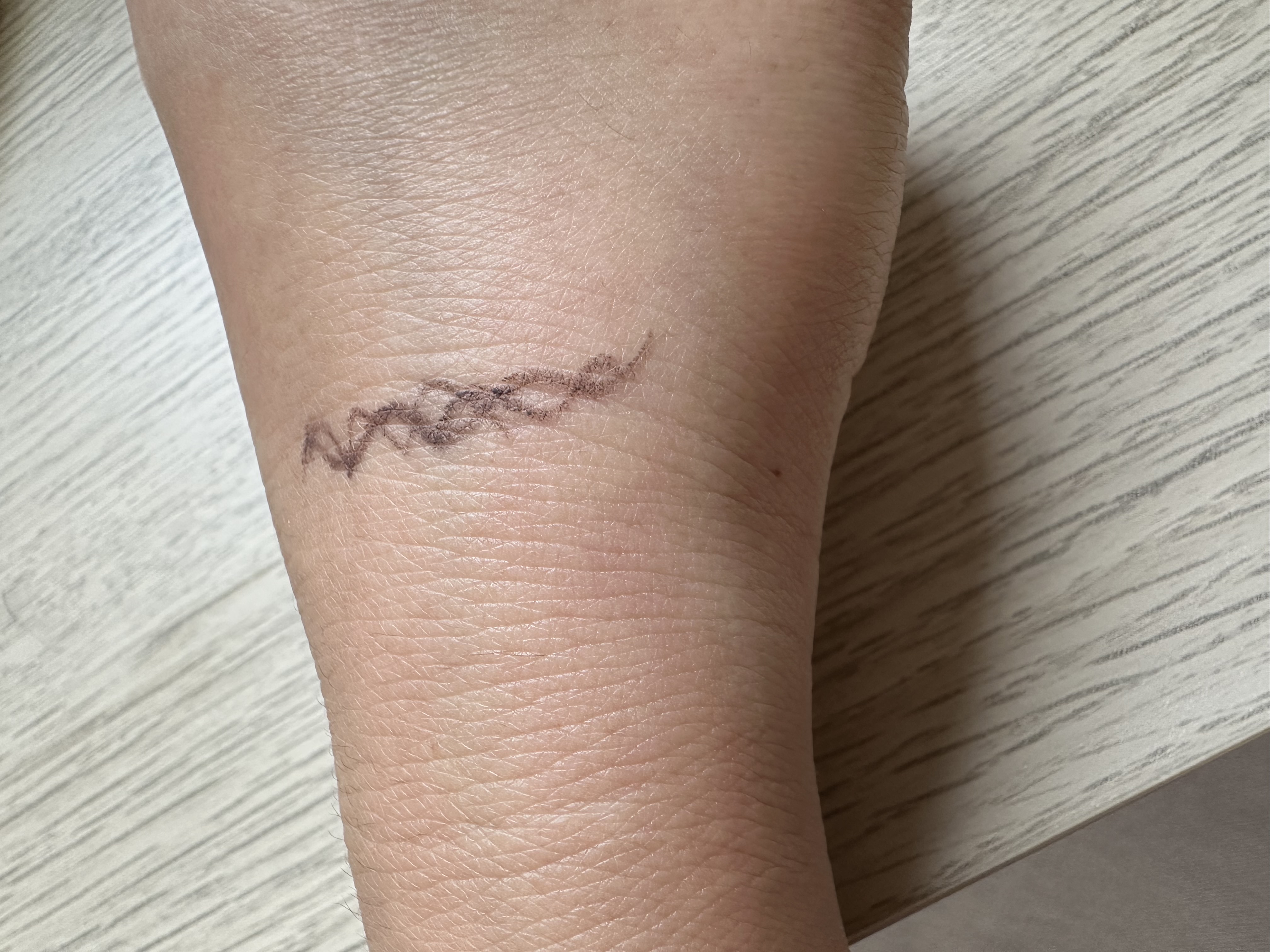 センテラ ライトクレンジングオイル/SKIN1004/オイルクレンジングを使ったクチコミ（2枚目）