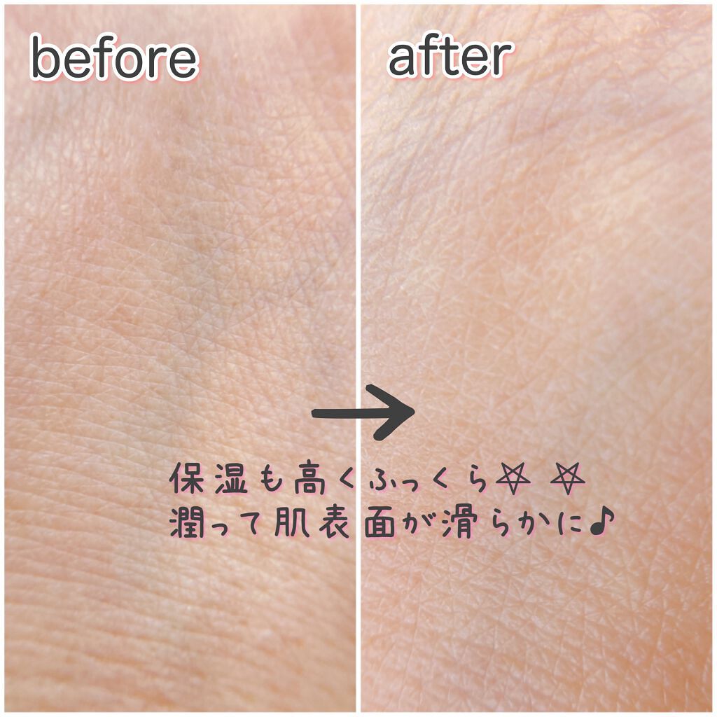 &be リペアクリーム/&be/フェイスクリームを使ったクチコミ(4枚目)