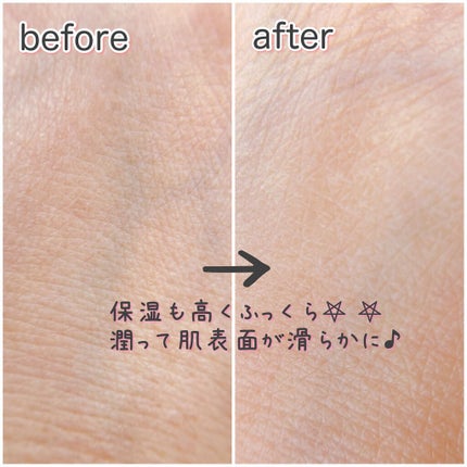 &be リペアクリーム/&be/フェイスクリームを使ったクチコミ(4枚目)