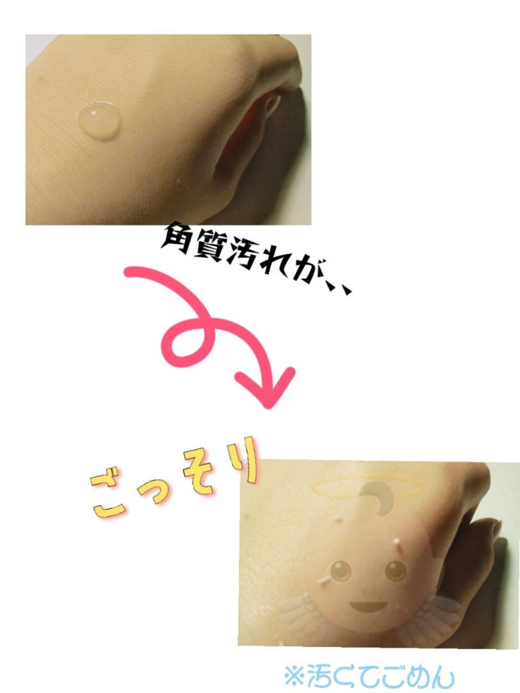 ロゼットゴマージュ/ロゼット/ピーリングを使ったクチコミ(3枚目)