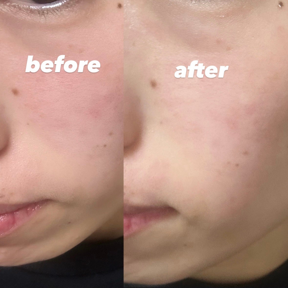 モデリングパック/Sunnicorn/シートマスク・パックを使ったクチコミ(8枚目)