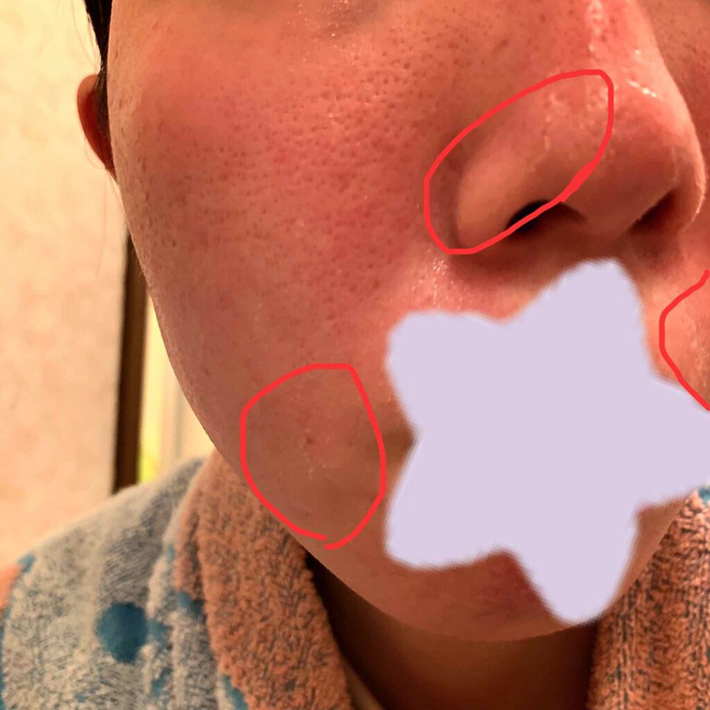 導入化粧液/無印良品/ブースター・導入液を使ったクチコミ(2枚目)