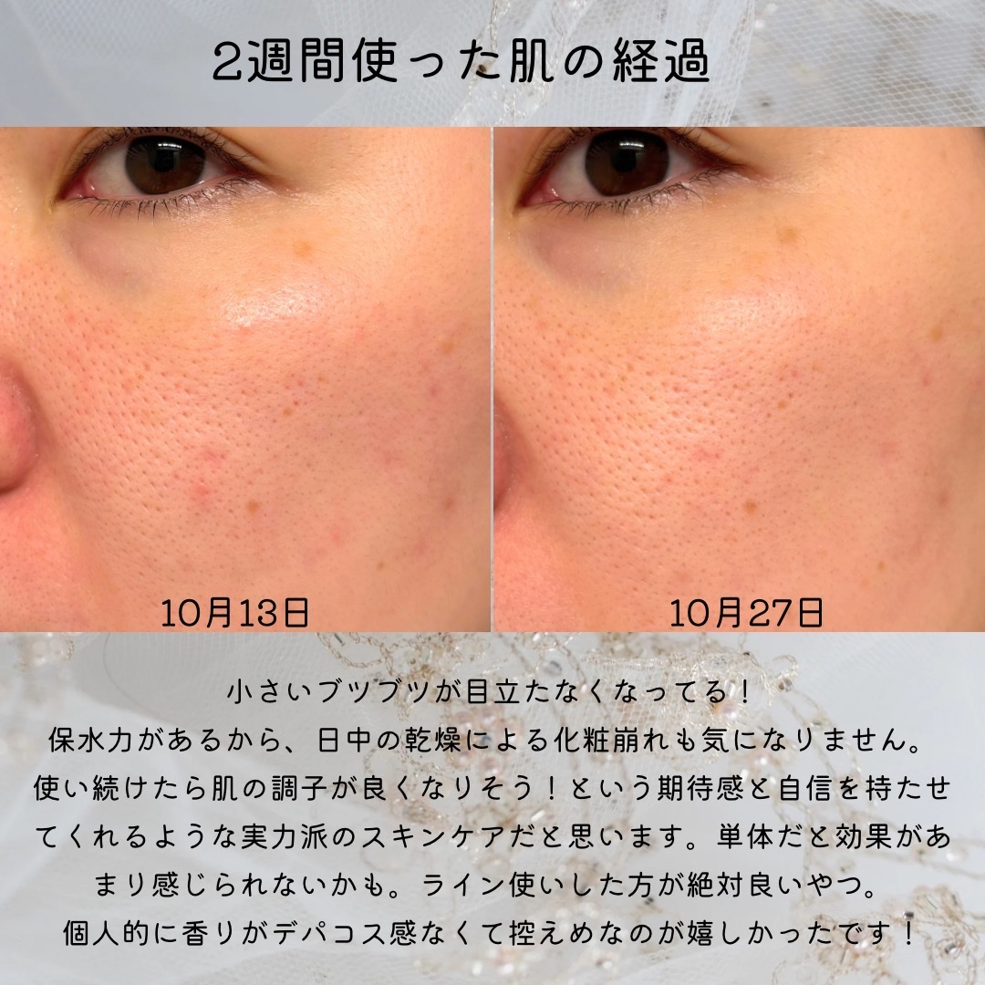 アクア チャージ 薬用 トリートメント ローション/ESTEE LAUDER/化粧水を使ったクチコミ（3枚目）