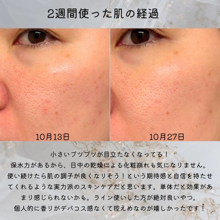 アクア チャージ 薬用 ミルキー クリーム/ESTEE LAUDER/フェイスクリームを使ったクチコミ(3枚目)
