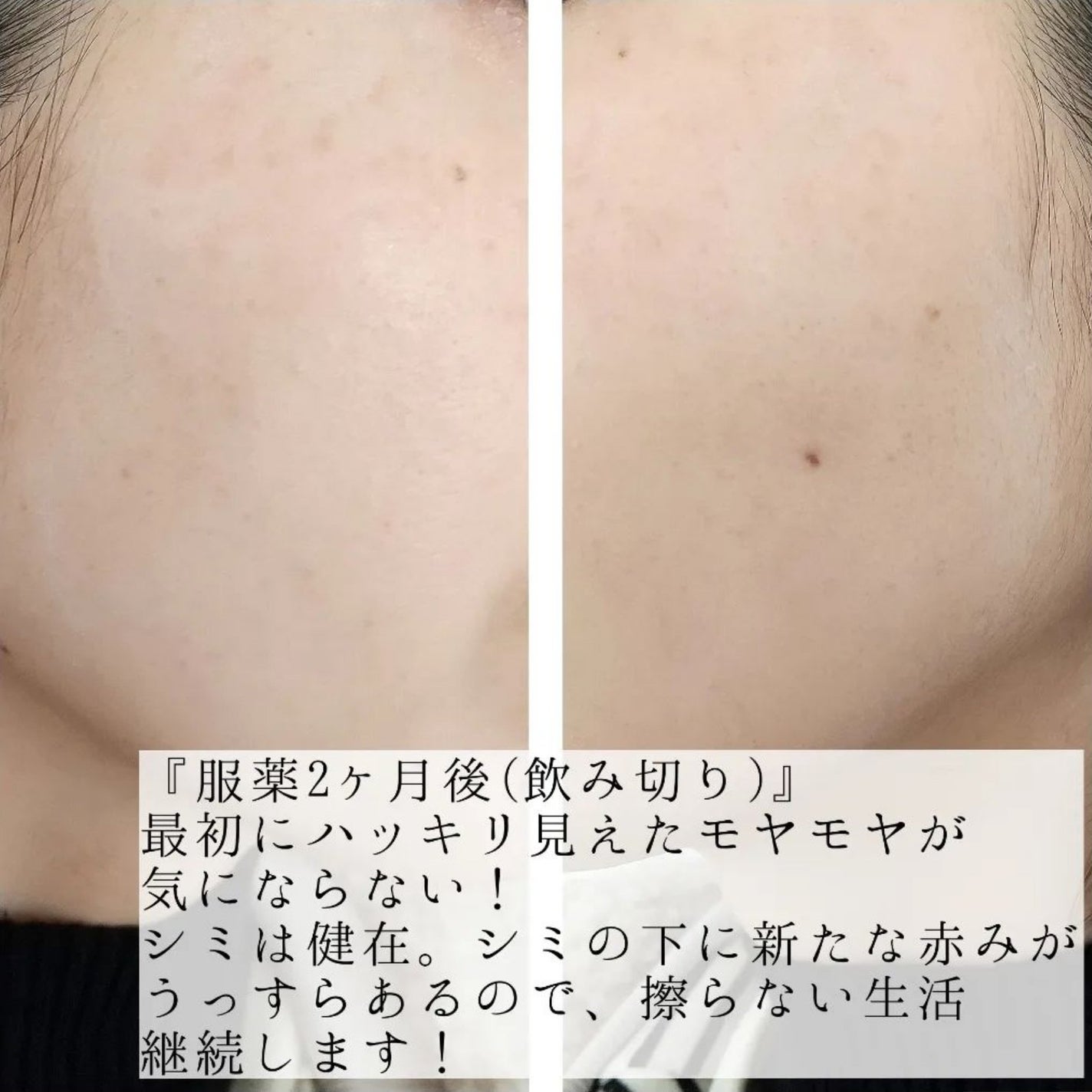 ハイドロクリームPHQ-5/KISO/フェイスクリームを使ったクチコミ(5枚目)