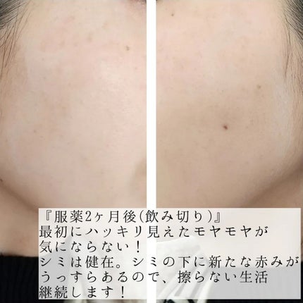 ハイドロクリームPHQ-5/KISO/フェイスクリームを使ったクチコミ(5枚目)