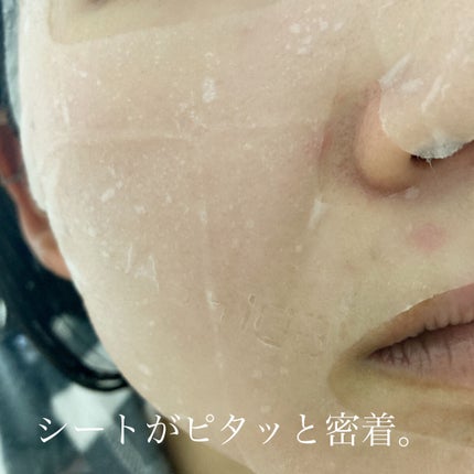 ティーツリーケアソリューション アンプルマスクJEX/MEDIHEAL/シートマスク・パックを使ったクチコミ(4枚目)