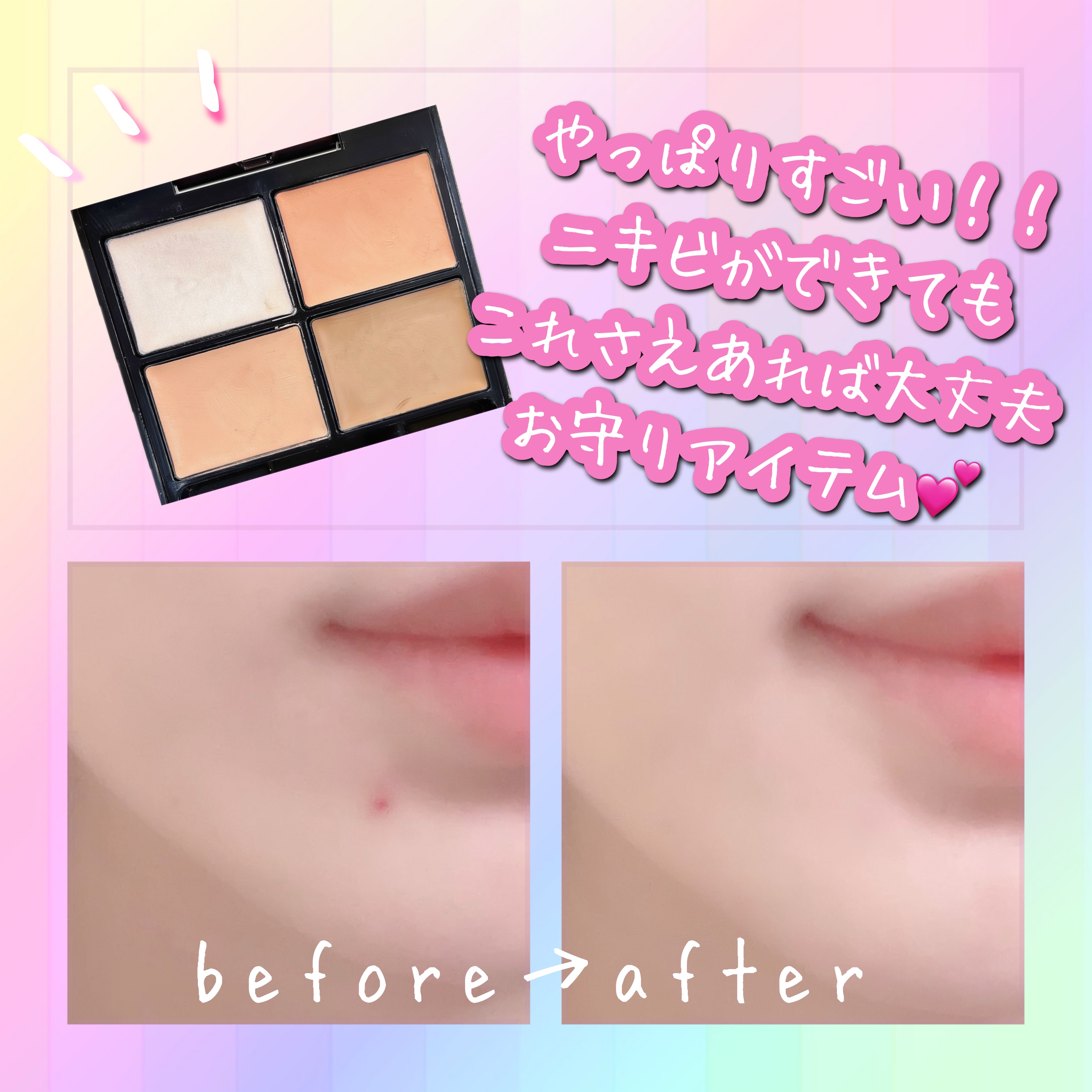 トーンパーフェクティング パレット/DECORTÉ/パレットコンシーラーを使ったクチコミ（2枚目）