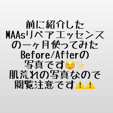 ドクターズチョイス MAAs リペアエッセンスのクチコミ「先日ポストしたMAAsリペアエッセンスの補足です😌✨..」（1枚目）