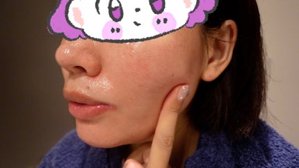 DW-EGFワンデイズアンプル/Easydew/美容液を使ったクチコミ(6枚目)