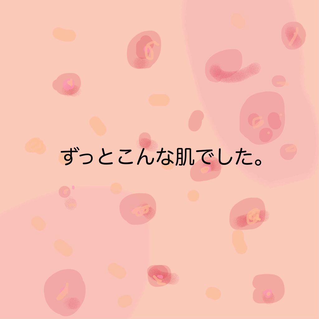 オードムーゲ 薬用ローション(ふきとり化粧水)/オードムーゲ/拭き取り化粧水を使ったクチコミ(4枚目)