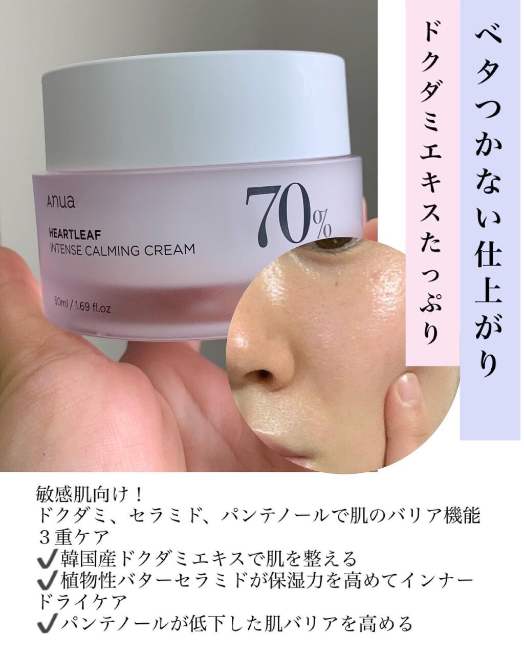 ドクダミ 70 インテンスカーミングクリーム/Anua/フェイスクリームを使ったクチコミ（2枚目）