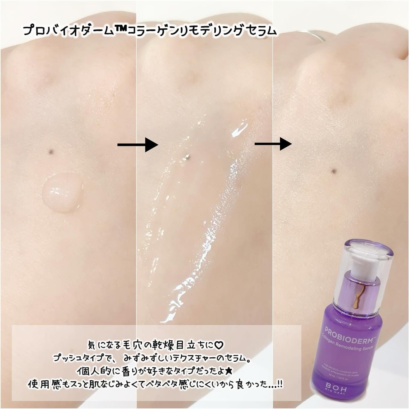 バイオヒールボ プロバイオダーム 3Dリフティングクリーム/BIOHEAL BOH/フェイスクリームを使ったクチコミ(3枚目)