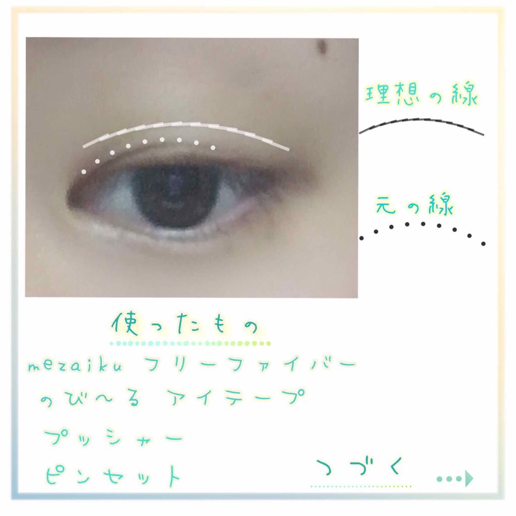 アイテープ(絆創膏タイプ、レギュラー、70枚)/DAISO/二重まぶた用アイテムを使ったクチコミ(2枚目)