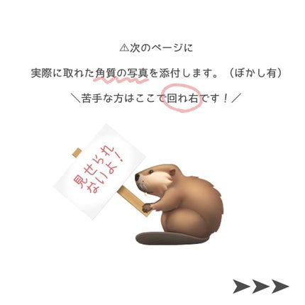 大豆エッセンス/mixsoon/美容液を使ったクチコミ(4枚目)