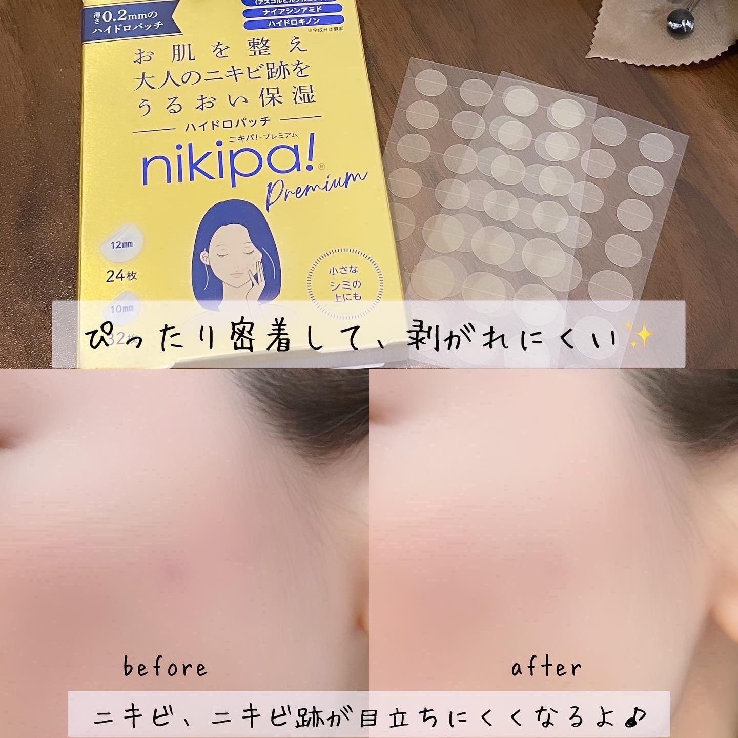 ニキパ! プレミアム ハイドロパッチ/金冠堂/その他スキンケアを使ったクチコミ（2枚目）