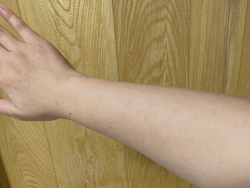 ちゃぽまる on LIPS 「美白系サプリメント💊シオノギ製薬のシナールLホワイトエクシアを..」(2枚目)