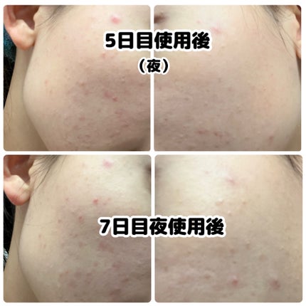 ベリーお元気?/ラッシュ/洗い流すパック・マスクを使ったクチコミ(8枚目)