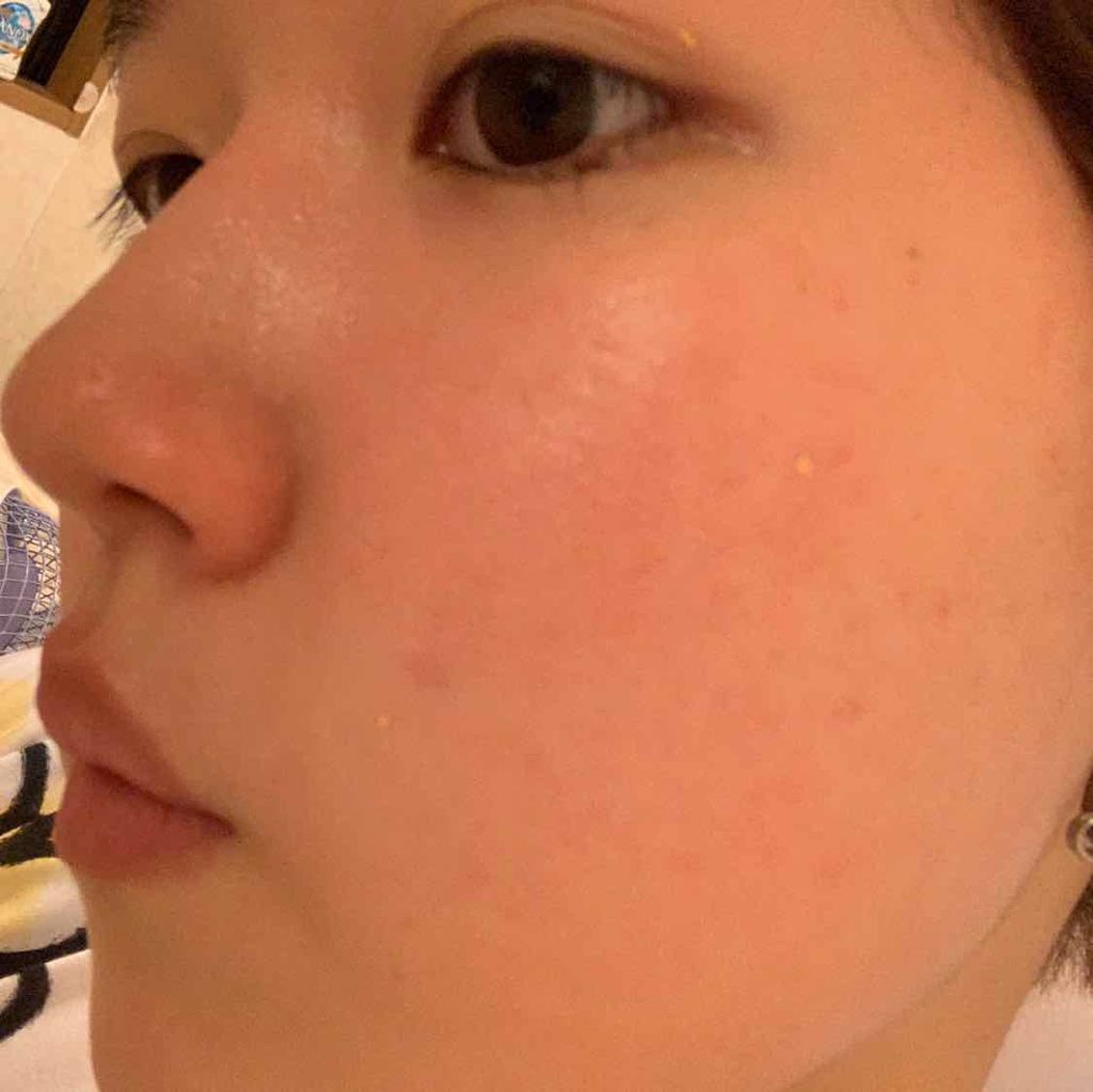 24K GOLD Repair Ampoule/HOLIKA HOLIKA/美容液を使ったクチコミ（3枚目）