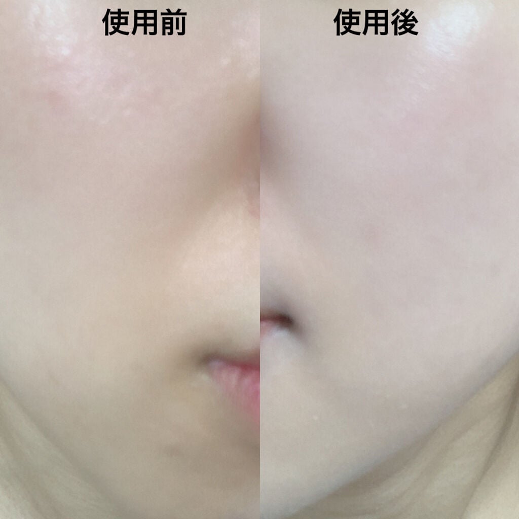 ザビタミンC23/IOPE/美容液を使ったクチコミ(3枚目)