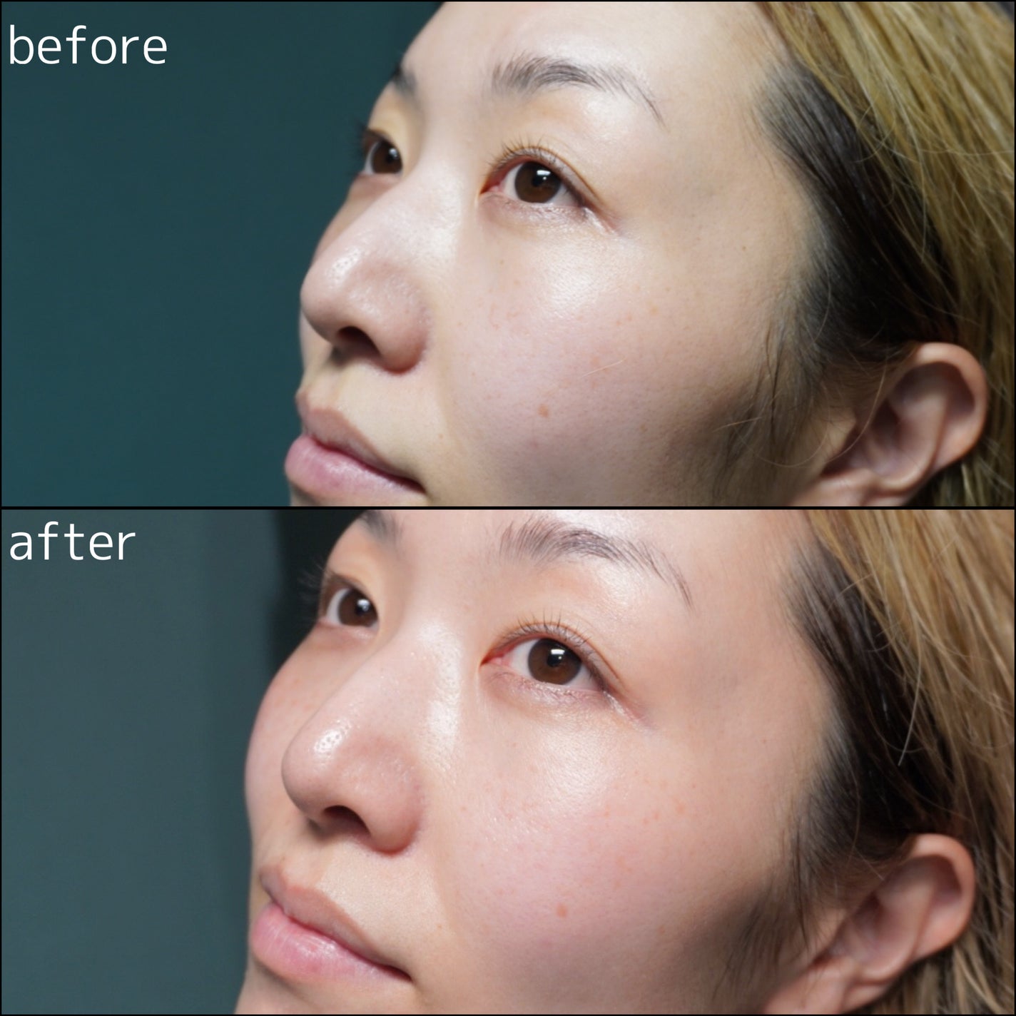 エーキュアトラブルカーミングセラム/obsero/美容液を使ったクチコミ(5枚目)