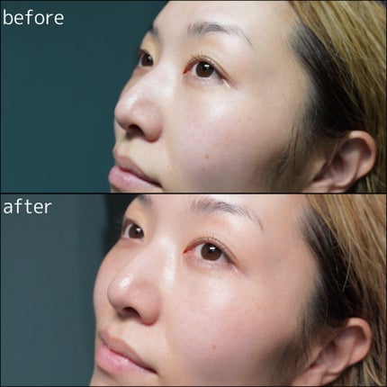 エーキュアトラブルカーミングセラム/obsero/美容液を使ったクチコミ(5枚目)