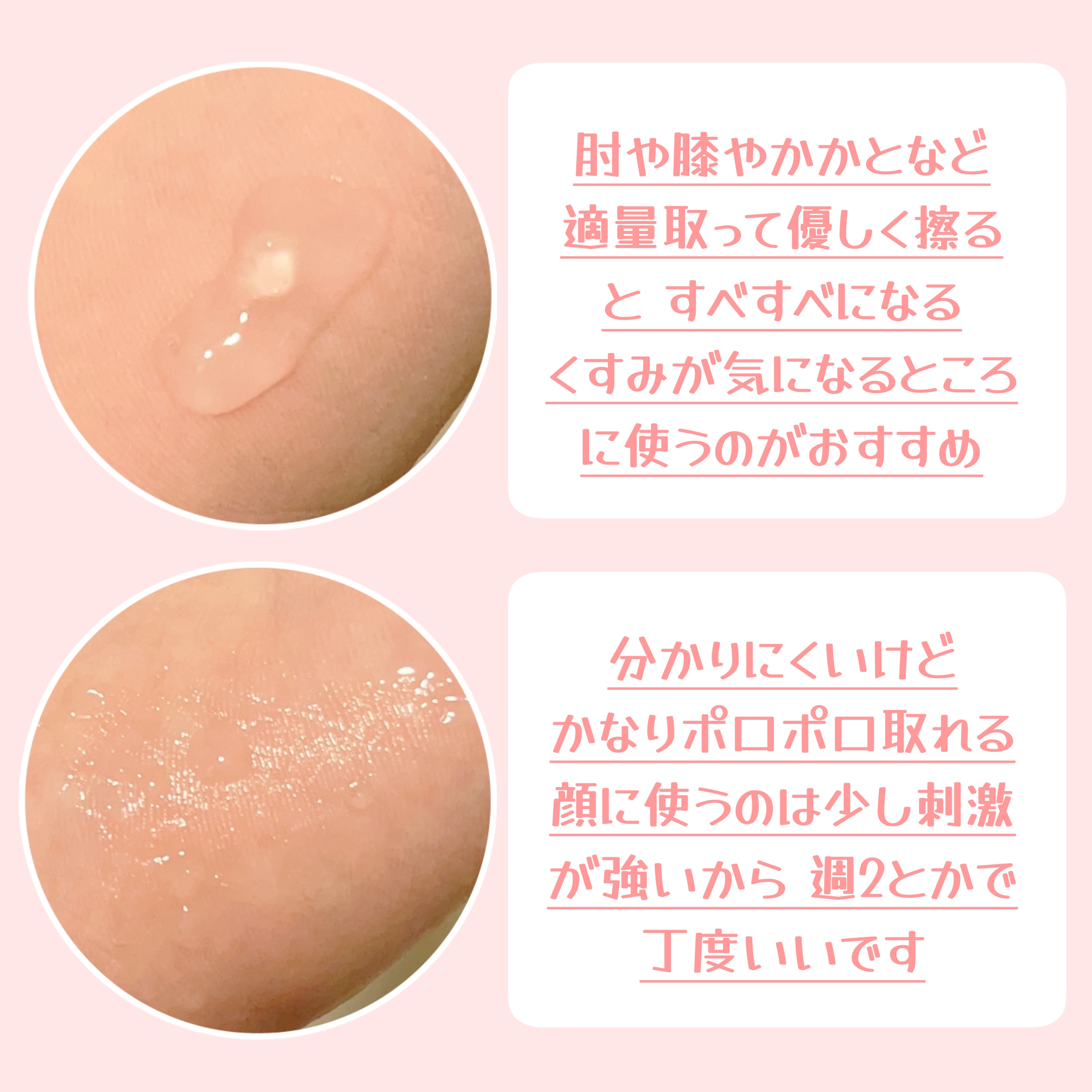 DETクリア ブライト＆ピール ピーリングジェリー <ミックスベリーの香り>/Detclear/ピーリングを使ったクチコミ（2枚目）