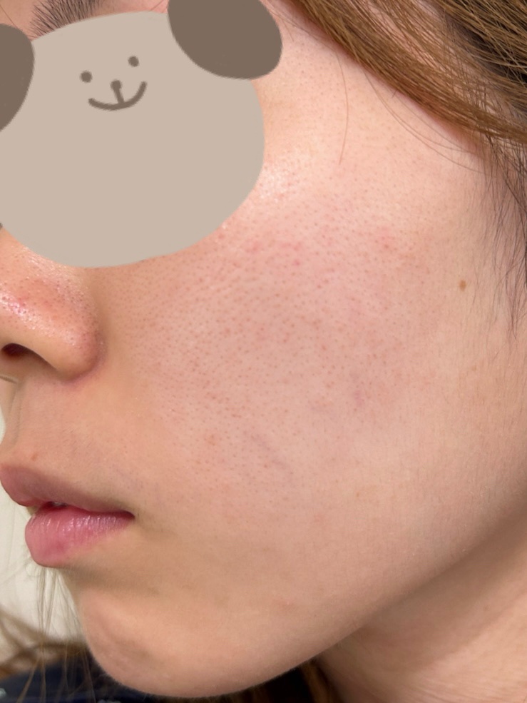 ビオレ おうちdeエステ メイク落とし マッサージブラックジェル/ビオレ/クレンジングジェルを使ったクチコミ（3枚目）