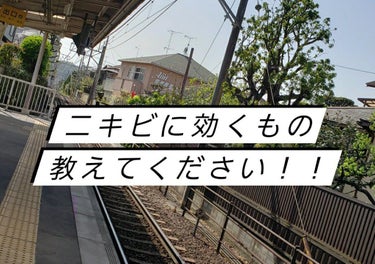 小学校の頃から始まりずっと悩み続けています、、
最近はこれでもだいぶ良くなりました！
もっと良くするためにはどうしたらいいのか
綺麗になる方法教えてください！
2枚目の写真はお見苦しいものを見せてしまい