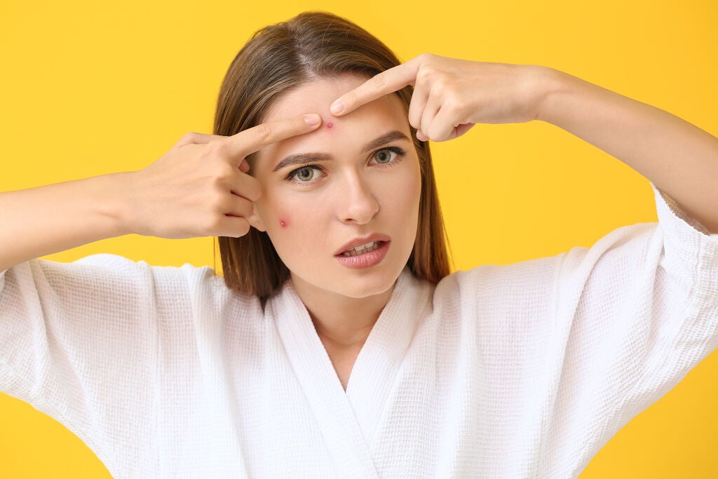 膿でパンパンのニキビは潰していい?潰れたらどうする?ニキビの原因とケア方法も解説のサムネイル