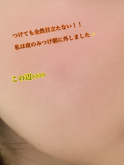 プロCICA クリアスポットパッチ/VT/その他スキンケアを使ったクチコミ(4枚目)