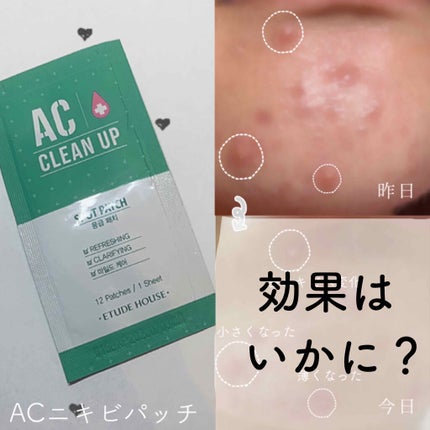 ACC パッチ/ETUDE/シートマスク・パックを使ったクチコミ(1枚目)