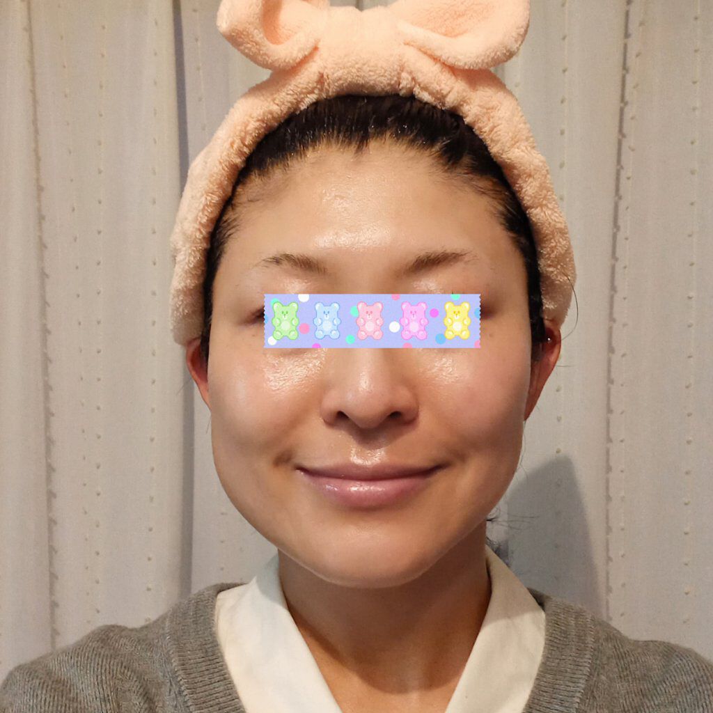 レチノールA 1% アドバンスドリバイタリゼーションクリーム/Life-flo/フェイスクリームを使ったクチコミ（1枚目）