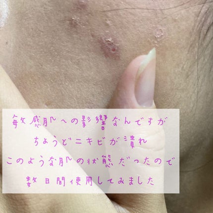 UVイデア XL プロテクショントーンアップ/ラ ロッシュ ポゼ/日焼け止めクリームを使ったクチコミ(9枚目)