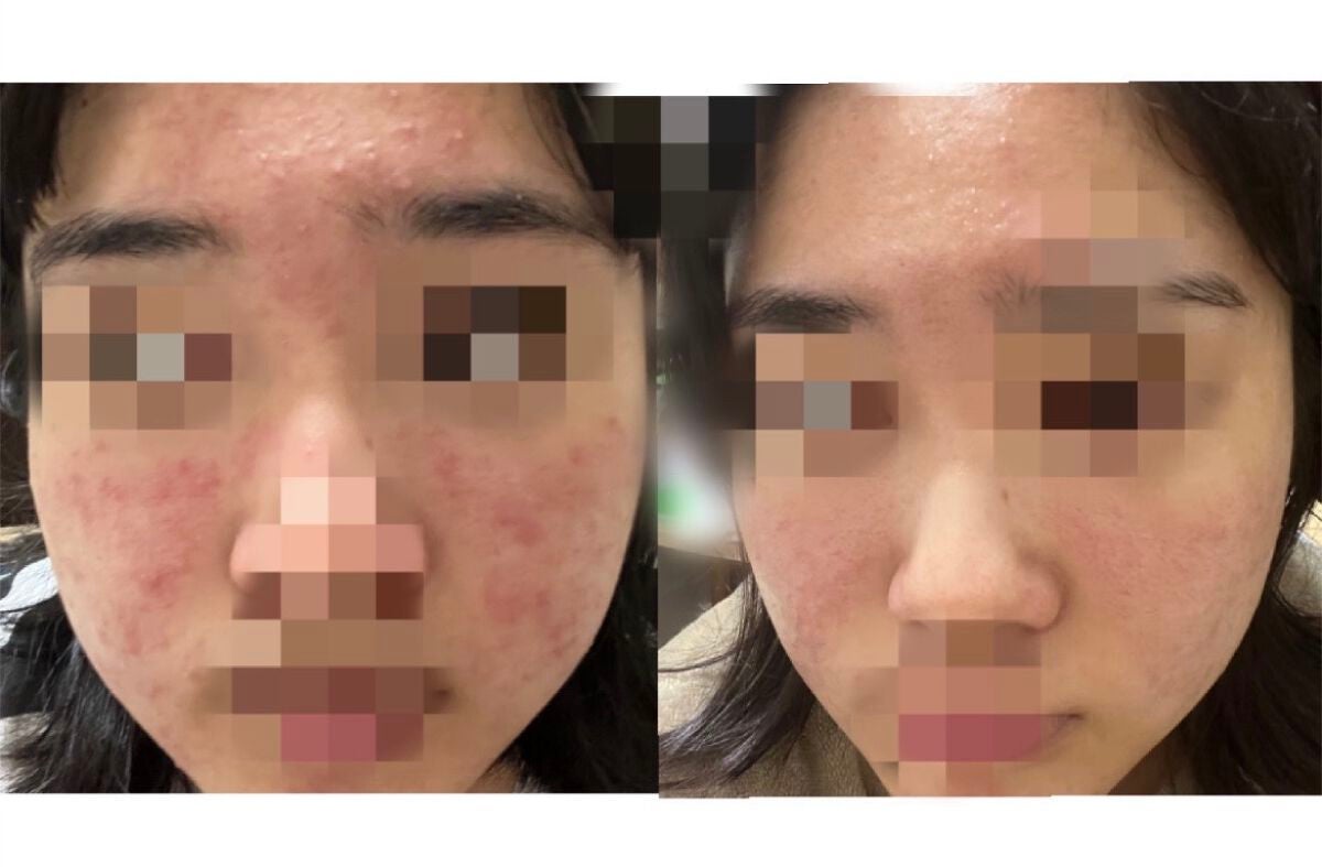 白潤 薬用美白乳液/肌ラボ/乳液を使ったクチコミ(2枚目)