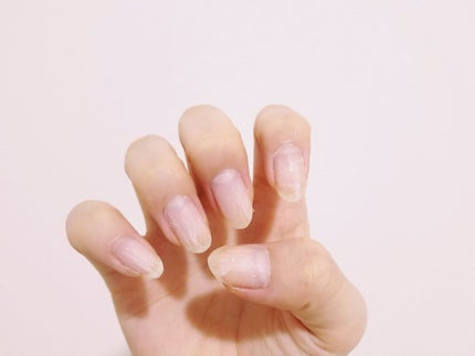 貼るジェルネイル/セリア/ネイルシールを使ったクチコミ(3枚目)