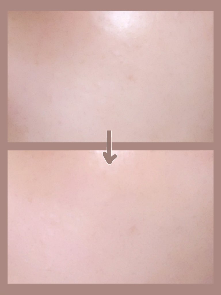 ピンクティーツリートナー/APLIN/化粧水を使ったクチコミ（2枚目）