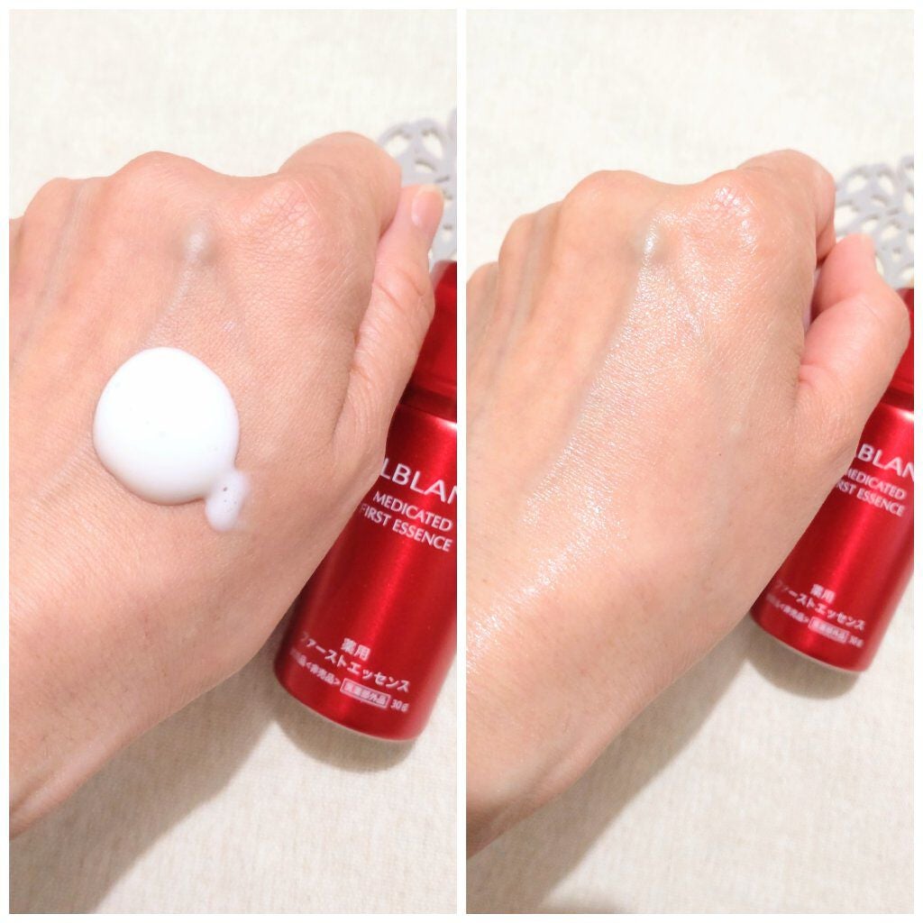薬用ファーストエッセンス/ALBLANC/ブースター・導入液を使ったクチコミ(4枚目)