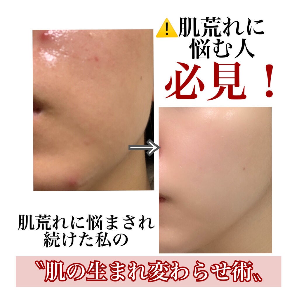 ティーツリーケアソリューション アンプルマスクJEX/MEDIHEAL/シートマスク・パックを使ったクチコミ(1枚目)