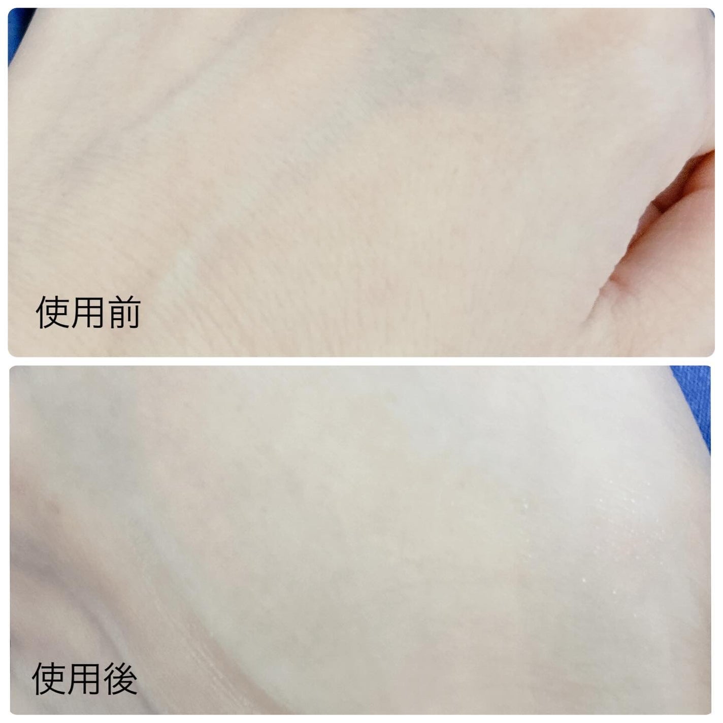 はづき みお on LIPS 「フレッシュリージュースドビタミンEマスク抗酸化に優れたビタミン..」(3枚目)