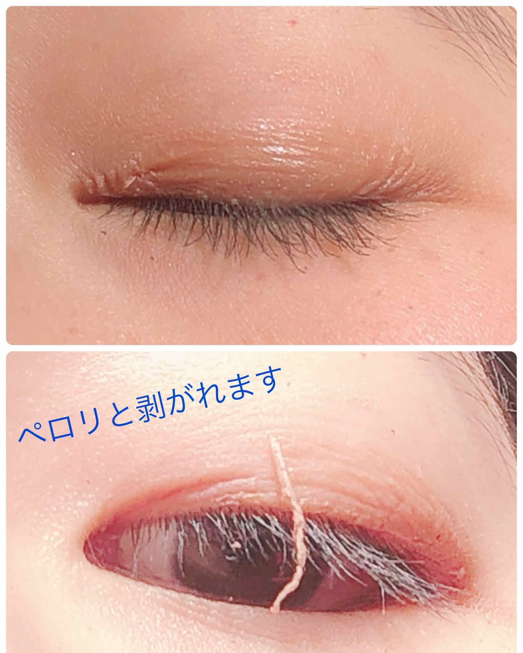 ハイブリッドフィルム/アイトーク/二重まぶた用アイテムを使ったクチコミ(3枚目)