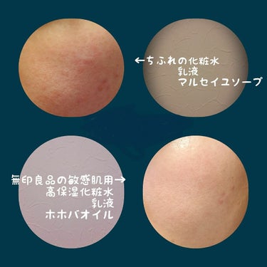 乳液・敏感肌用・高保湿タイプ/無印良品/乳液を使ったクチコミ（2枚目）